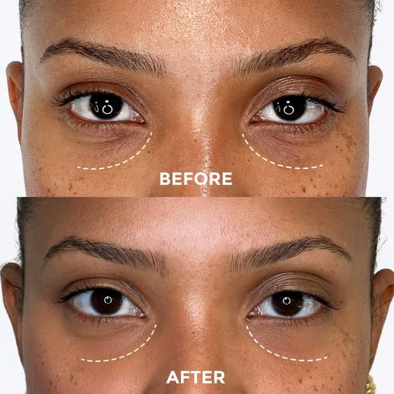 NOORÉA – Reusable Under-Eye Patches